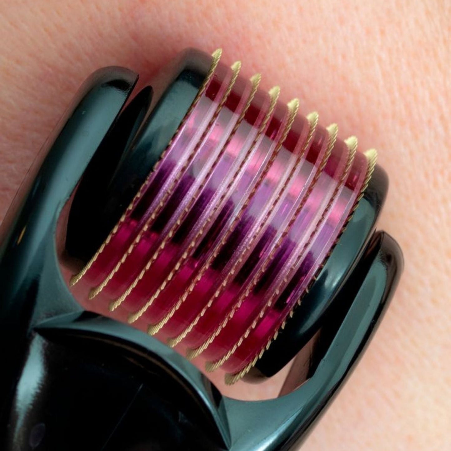 Derma-Roller - DOGOMET DIGITAL PLUS