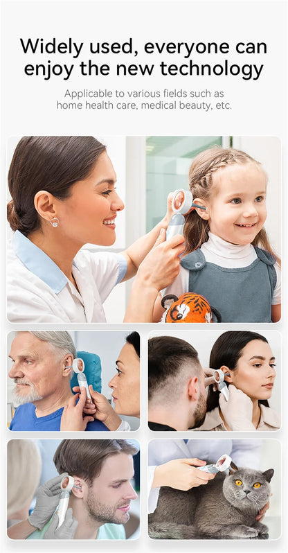 Caméra auriculaire visuelle Endoscope sans fil, écran IPS 1.38 pouces, outils de nettoyage de cire auriculaire, caméras HD 1080P, prise de photo, vidéo, Inspection auditive