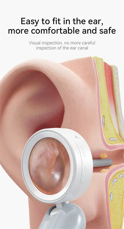 Caméra auriculaire visuelle Endoscope sans fil, écran IPS 1.38 pouces, outils de nettoyage de cire auriculaire, caméras HD 1080P, prise de photo, vidéo, Inspection auditive